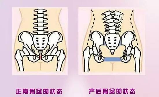 骨盆比较.jpg