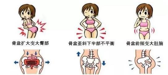 骨盆图.jpg